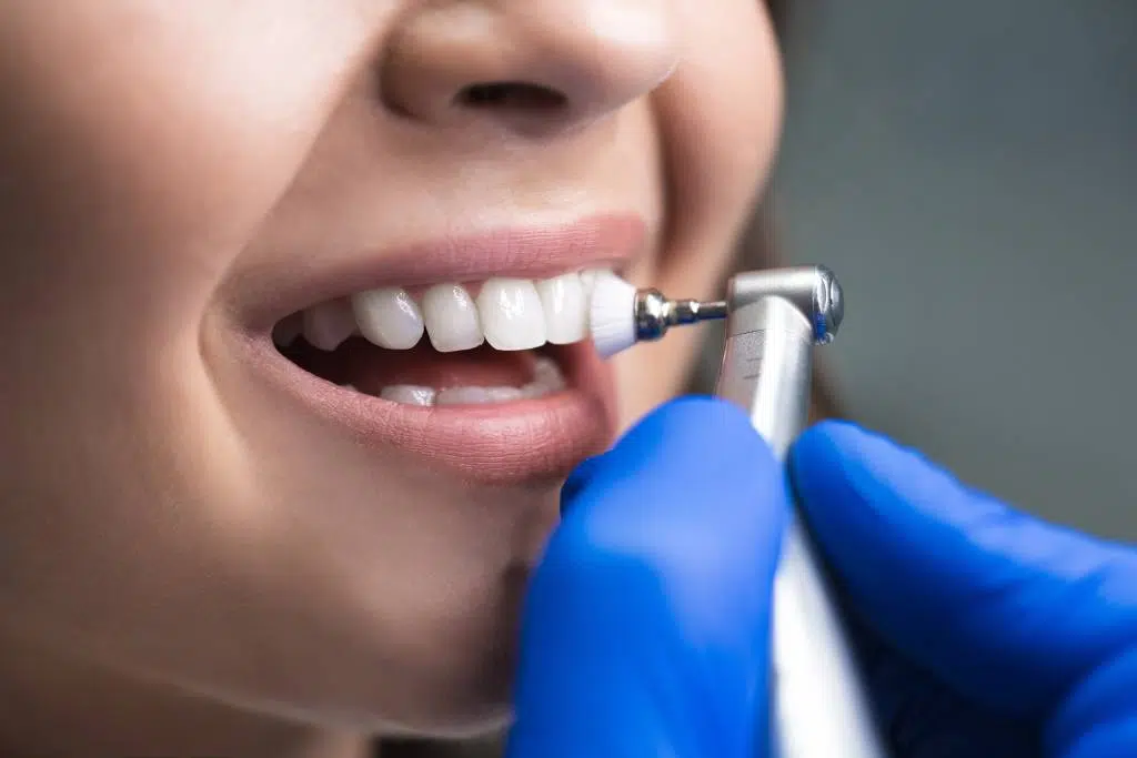 Why Regular Dental Cleanings Are Essential for a Healthy Smile