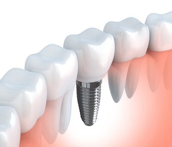 iStock_000040428576_Small-1